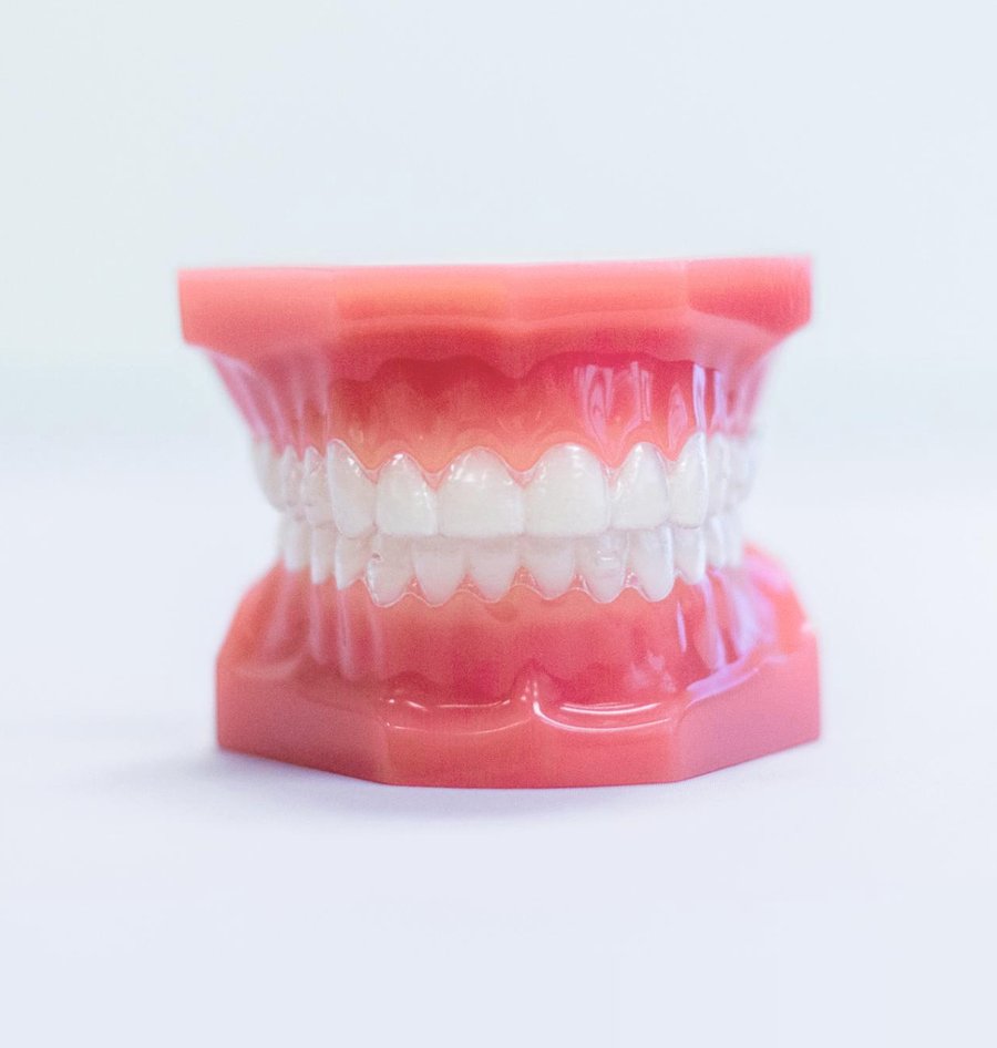 clear aligners photo