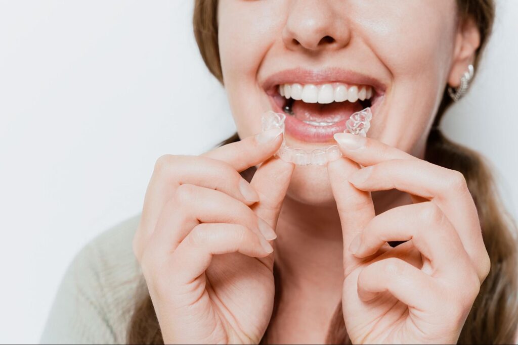 Patient inserting Spark clear aligners