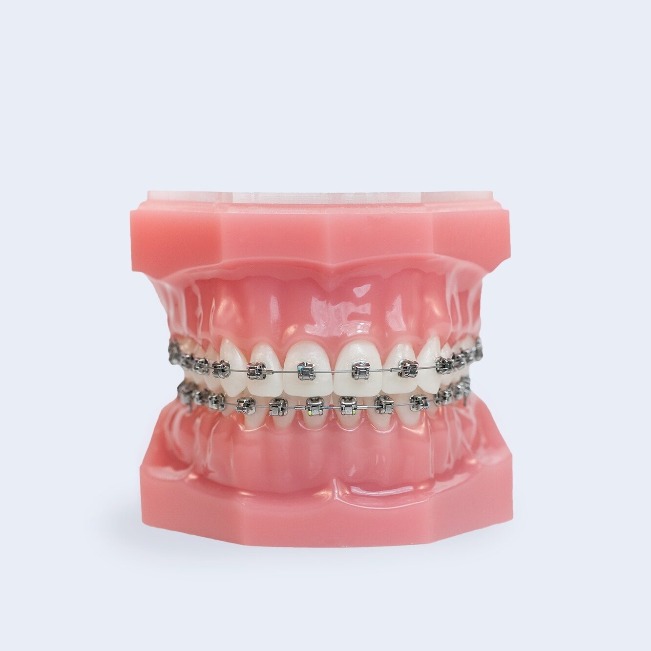 Dillsburg Braces