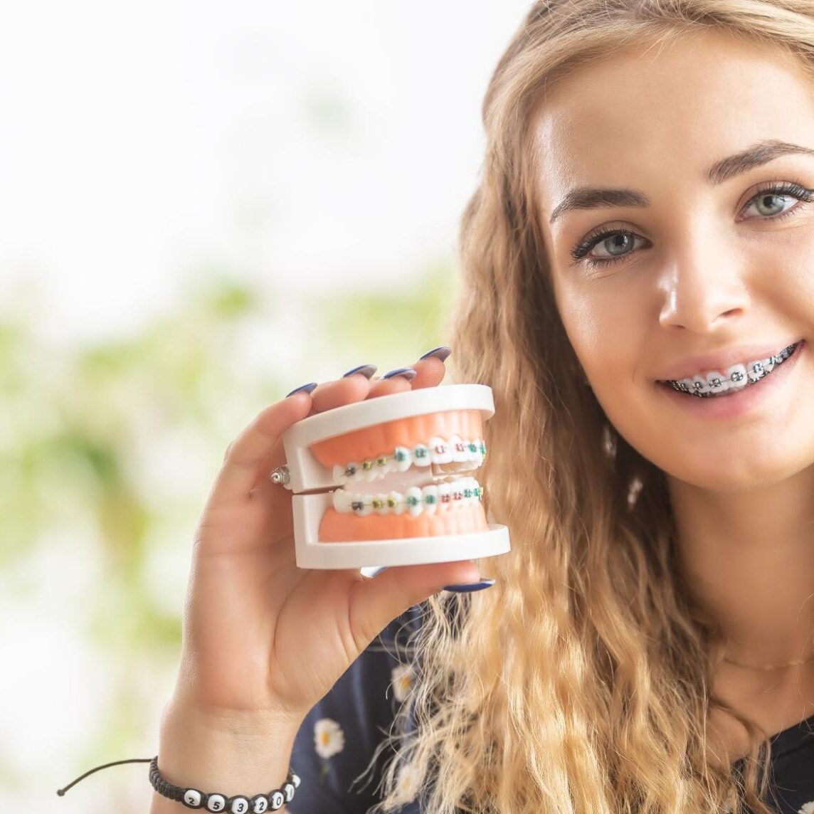 What Are the Main Elements of Braces?